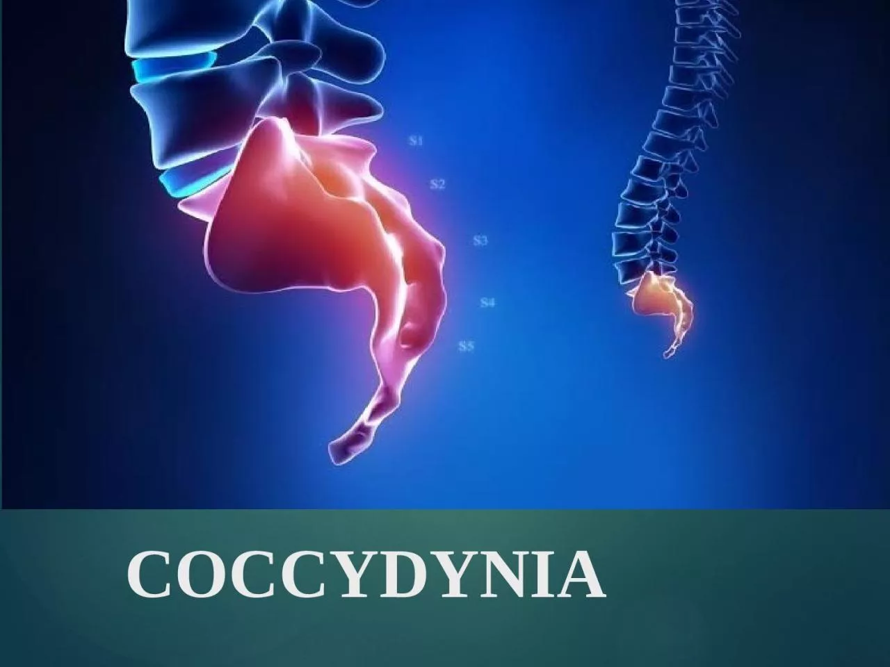 PPT-COCCYDYNIA Coccydynia is pain felt in the area of the coccyx, or tailbone. The coccyx