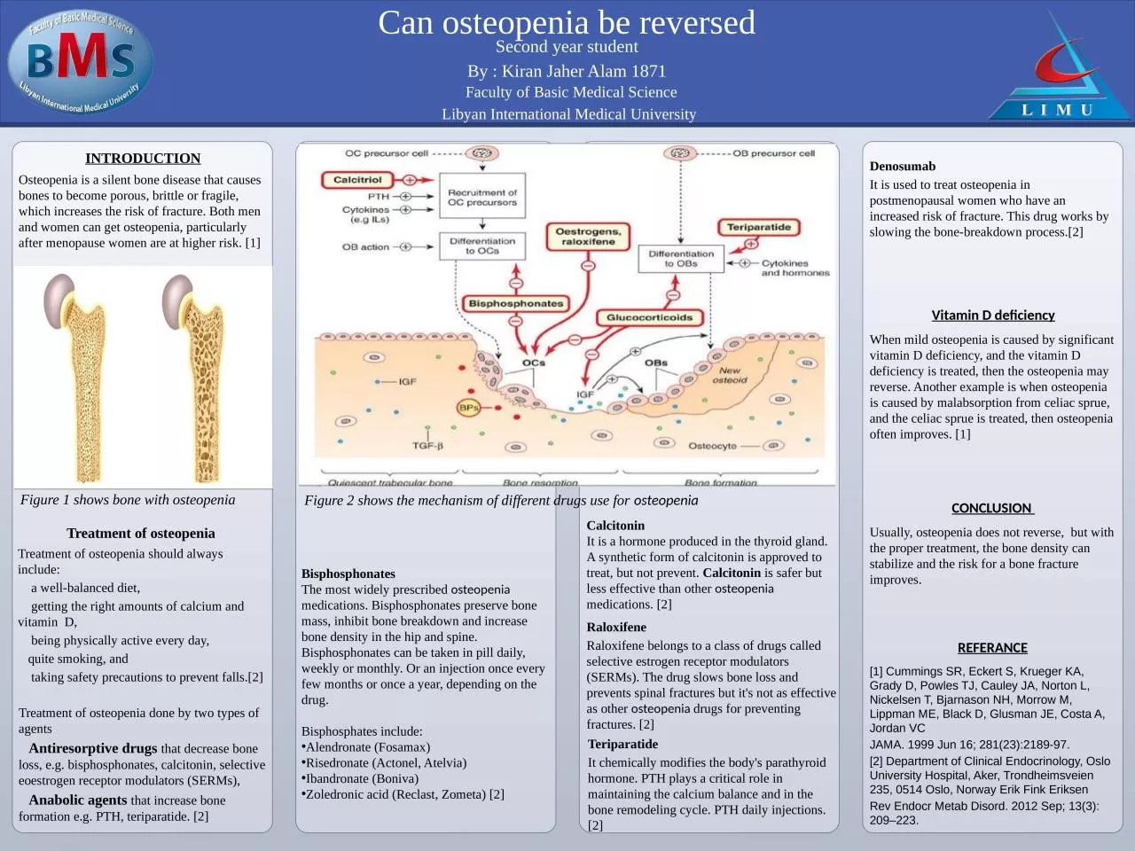 PPT-Osteopenia is a silent bone disease that causes bones to become