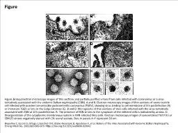 Figure Figure.&nbsp;Electron microscopy images of thin sections and partially purified