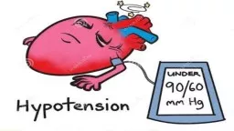 DEFINITION Hypotension, also commonly known as low blood pressure is a condition in which