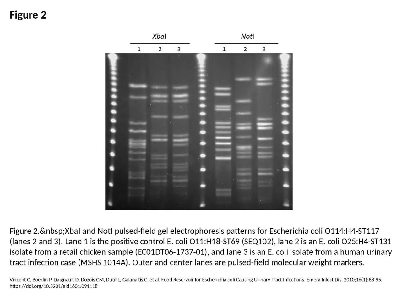 PPT-Figure 2 Figure 2.&nbsp;XbaI and NotI pulsed-field gel electrophoresis patterns for