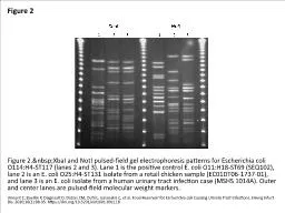 Figure 2 Figure 2.&nbsp;XbaI and NotI pulsed-field gel electrophoresis patterns for