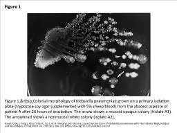 Figure 1 Figure 1.&nbsp;Colonial morphology of Klebsiella pneumoniae grown on a primary isolati