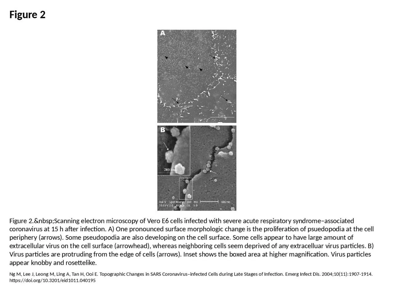 PPT-Figure 2 Figure 2.&nbsp;Scanning electron microscopy of Vero E6 cells infected with