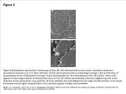 Figure 2 Figure 2.&nbsp;Scanning electron microscopy of Vero E6 cells infected with