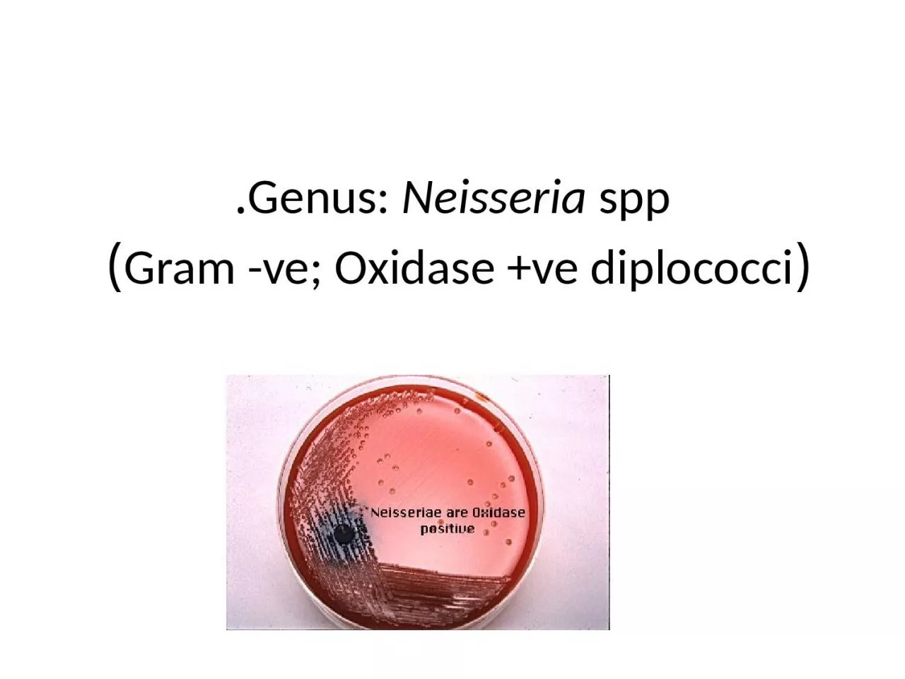 Genus:  Neisseria  spp. (Gram -ve; Oxidase +ve diplococci)