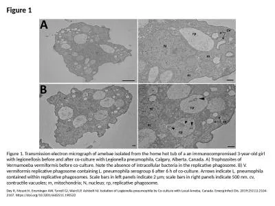 Figure 1 Figure 1. Transmission electron micrograph of amebae isolated from the home hot