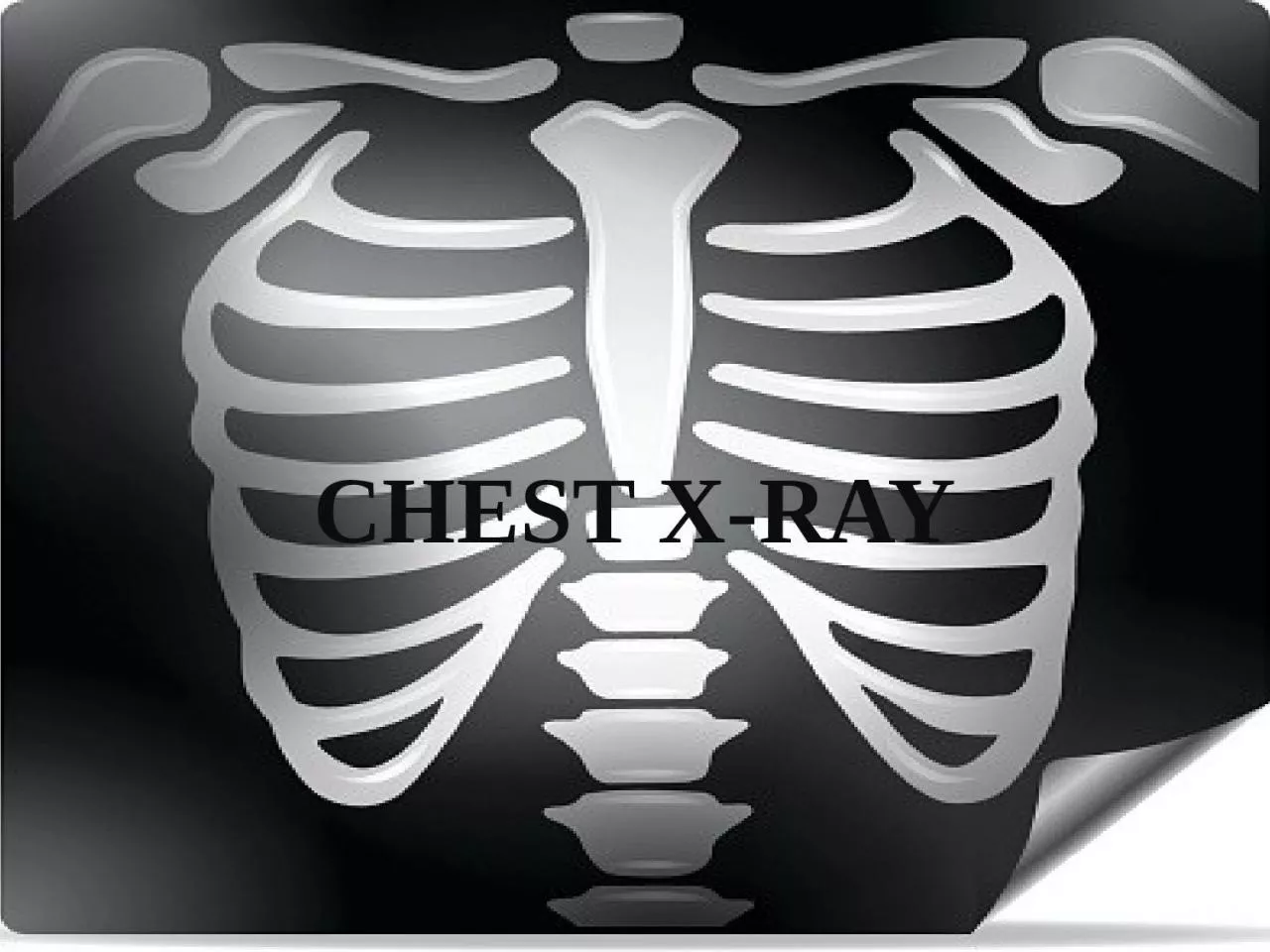 PPT-CHEST X-RAY Wilhelm Konrad