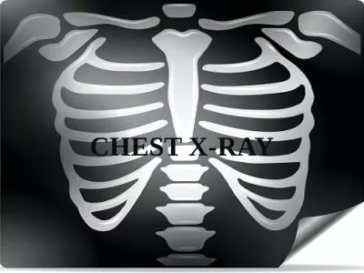 CHEST X-RAY Wilhelm  Konrad