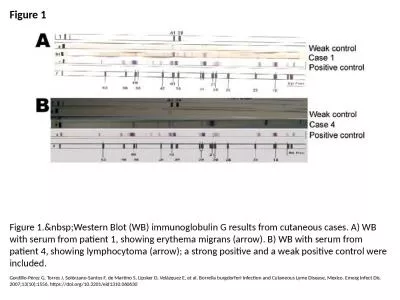 Figure 1 Figure 1.&nbsp;Western Blot (WB) immunoglobulin G results from cutaneous
