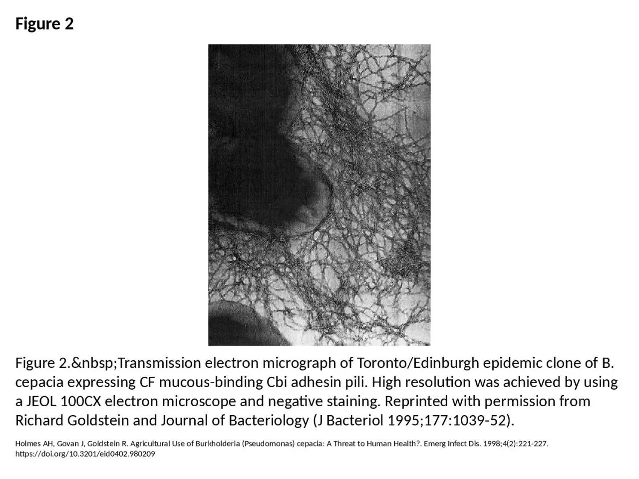 PPT-Figure 2 Figure 2.&nbsp;Transmission electron micrograph of Toronto/Edinburgh epidemic