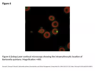 Figure 6 Figure 6.&nbsp;Laser confocal microscopy showing the intraerythrocytic location