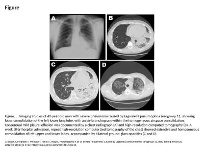 Figure Figure. . . Imaging studies of 42-year-old man with severe pneumonia caused by