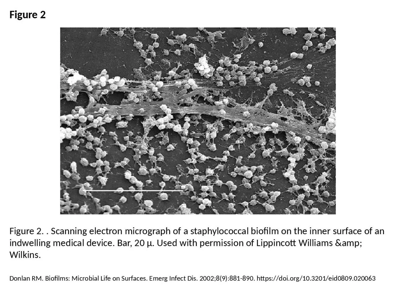 PPT-Figure 2 Figure 2. . Scanning electron micrograph of a staphylococcal biofilm on the inner