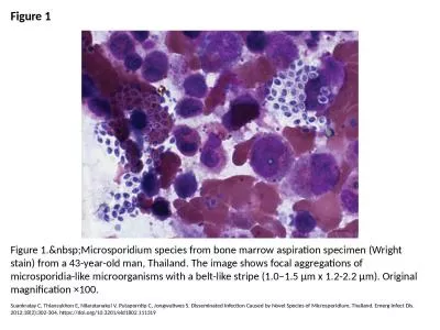 Figure 1 Figure 1.&nbsp;Microsporidium species from bone marrow aspiration specimen