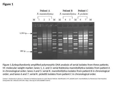 Figure 1 Figure 1.&nbsp;Randomly amplified polymorphic DNA analysis of serial isolates