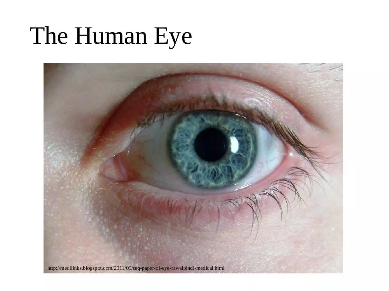 PPT-The Human Eye http:// medilinks.blogspot.com