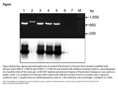 Figure Figure.&nbsp;Top, agarose gel electrophoresis of nested PCR products of human