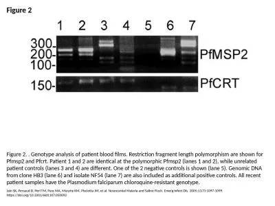 Figure 2 Figure 2. . Genotype analysis of patient blood films. Restriction fragment length