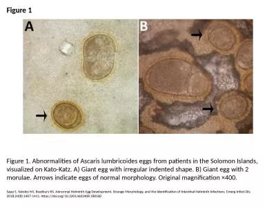 Figure 1 Figure 1. Abnormalities of Ascaris lumbricoides eggs from patients in the Solomon