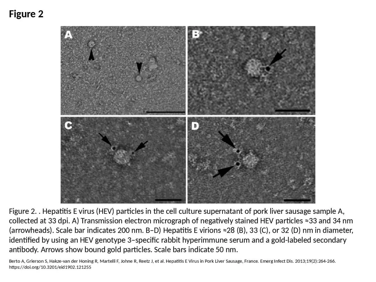 PPT-Figure 2 Figure 2. . Hepatitis E virus (HEV) particles in the cell culture supernatant