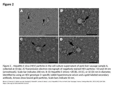 Figure 2 Figure 2. . Hepatitis E virus (HEV) particles in the cell culture supernatant