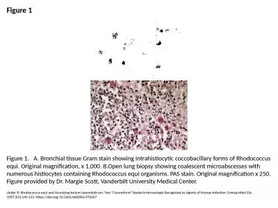 Figure 1 Figure 1. 	 A. Bronchial tissue Gram stain showing intrahistiocytic coccobacillary