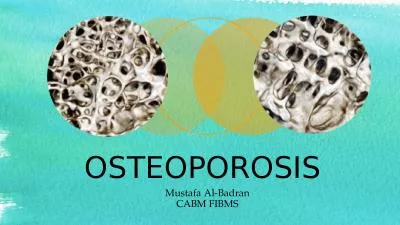 OSTEOPOROSIS  Mustafa Al-Badran