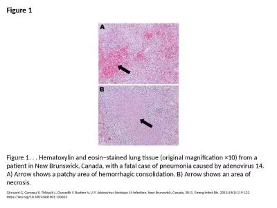 Figure 1 Figure 1. . . Hematoxylin and eosin–stained lung tissue (original magnification ×10) fr