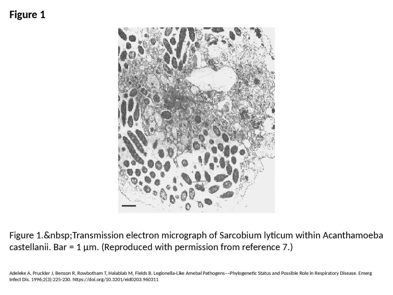 PPT-Figure 1 Figure 1.&nbsp;Transmission electron micrograph of Sarcobium lyticum within