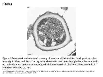 Figure 2 Figure 2. Transmission electron microscopy of microsporidia identified in allograft