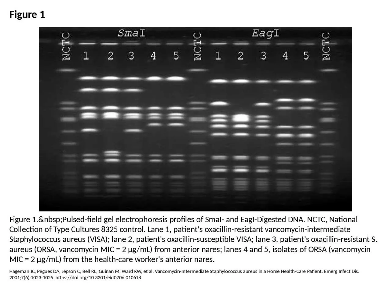 PPT-Figure 1 Figure 1.&nbsp;Pulsed-field gel electrophoresis profiles of SmaI- and EagI-Digested