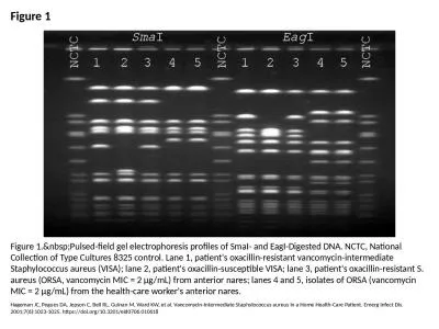 Figure 1 Figure 1.&nbsp;Pulsed-field gel electrophoresis profiles of SmaI- and EagI-Digested DN