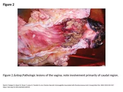 Figure 2 Figure 2.&nbsp;Pathologic lesions of the vagina; note involvement primarily of caudal