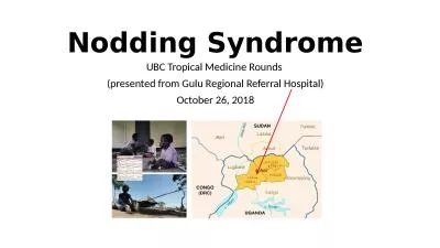 Nodding Syndrome UBC Tropical Medicine Rounds