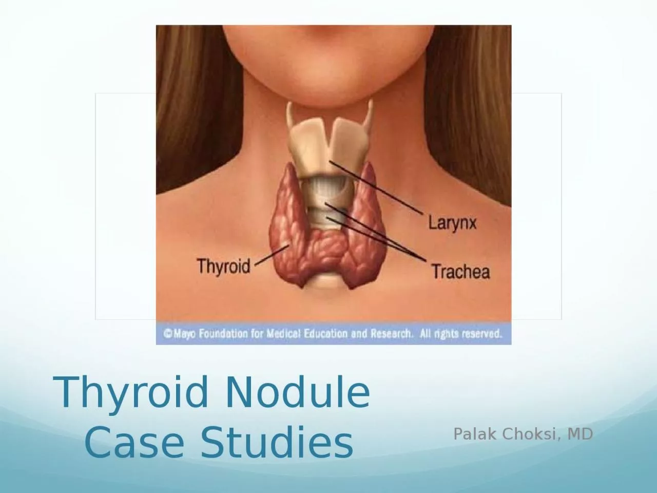 PPT-Thyroid Nodule Case Studies