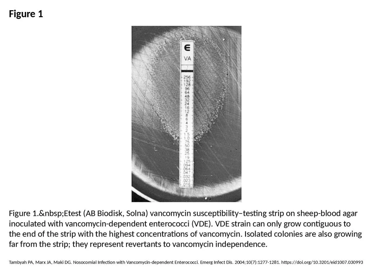 PPT-Figure 1 Figure 1.&nbsp;Etest (AB Biodisk, Solna) vancomycin susceptibility–testing