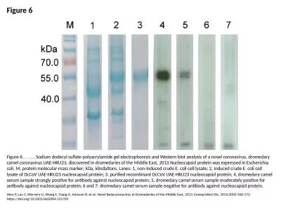 Figure 6 Figure 6. . . . . . Sodium dodecyl sulfate-polyacrylamide gel electrophoresis and Western