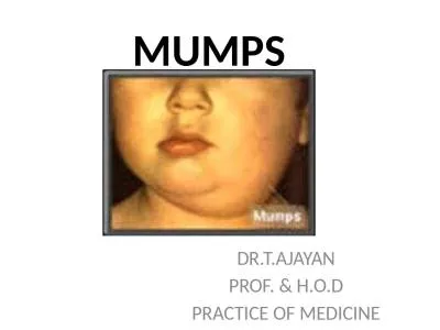 MUMPS DR.T.AJAYAN PROF. & H.O.D