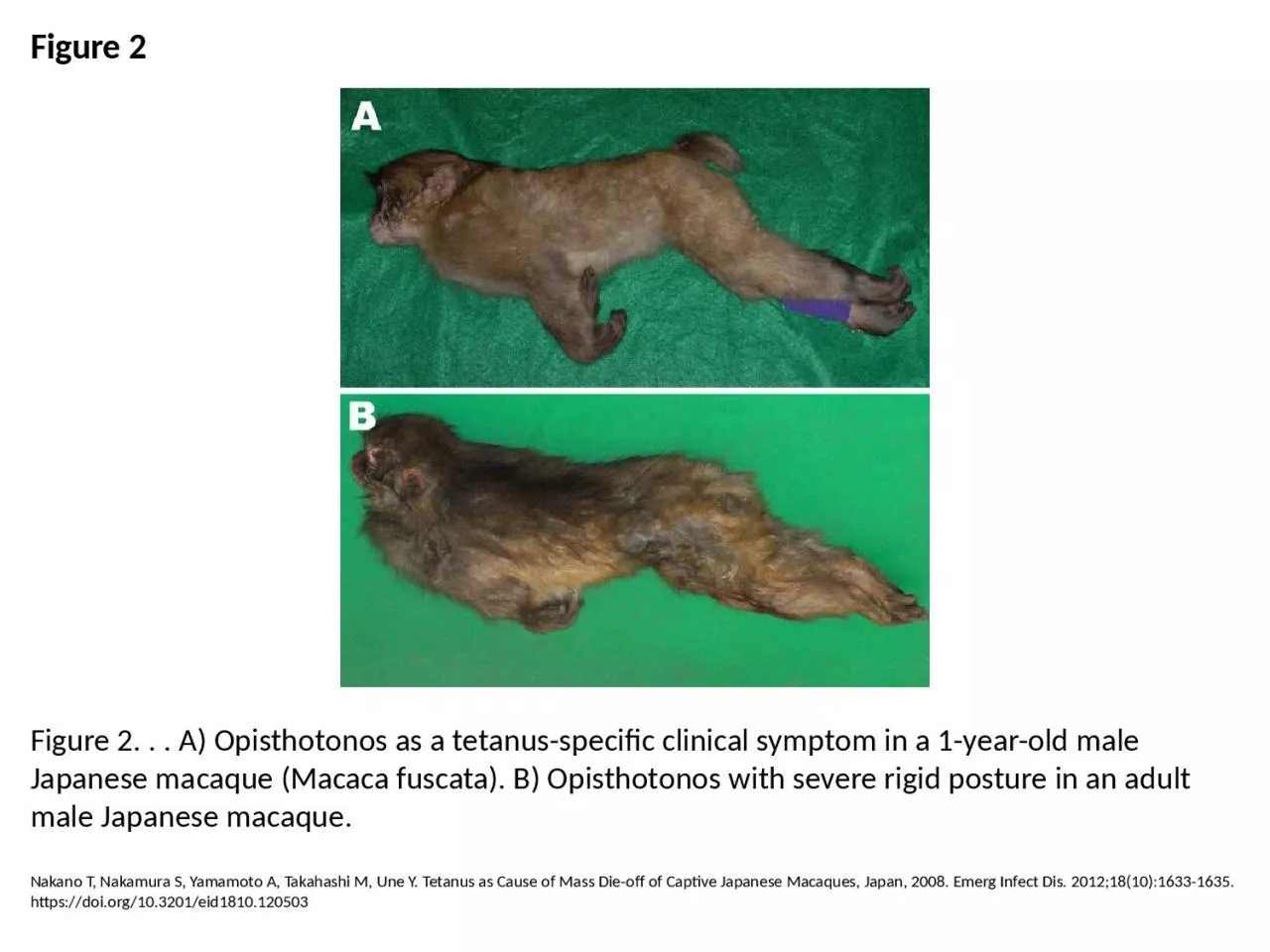 PPT-Figure 2 Figure 2. . . A) Opisthotonos as a tetanus-specific clinical symptom in a 1-year-old