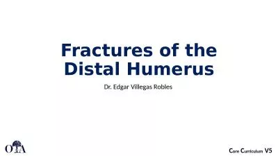 Fractures of the Distal Humerus