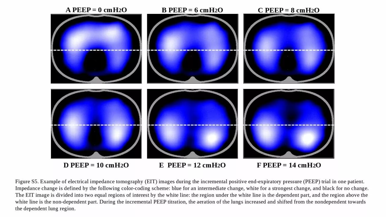 PPT-A PEEP = 0 cmH 2 O B PEEP = 6 cmH