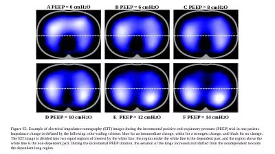 A PEEP = 0 cmH 2 O B PEEP = 6 cmH