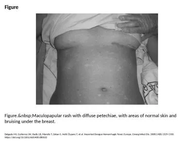 Figure Figure.&nbsp;Maculopapular rash with diffuse petechiae, with areas of normal skin and br