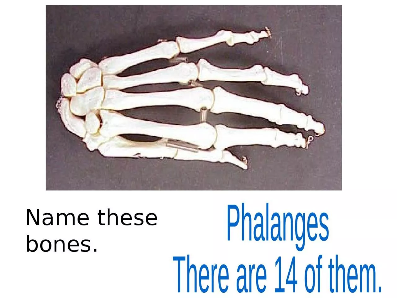 PPT-Name these bones. Phalanges