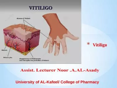 Vitiligo University of  AL-