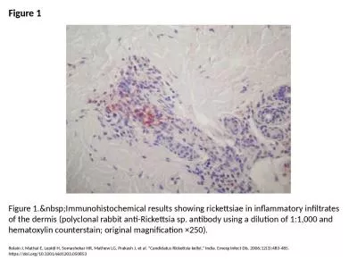 Figure 1 Figure 1.&nbsp;Immunohistochemical results showing rickettsiae in inflammatory infiltr