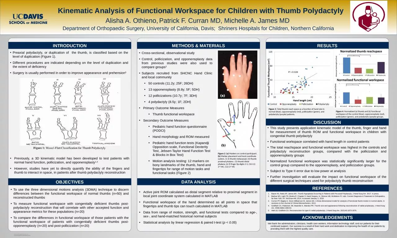 PPT-Preaxial polydactyly, or duplication of the thumb, is classified based on the level of