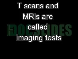 T scans and MRIs are called imaging tests