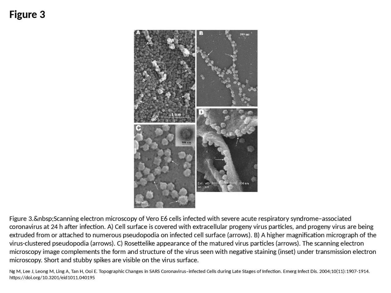 PPT-Figure 3 Figure 3.&nbsp;Scanning electron microscopy of Vero E6 cells infected with